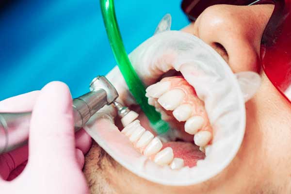 turkish dental treatment