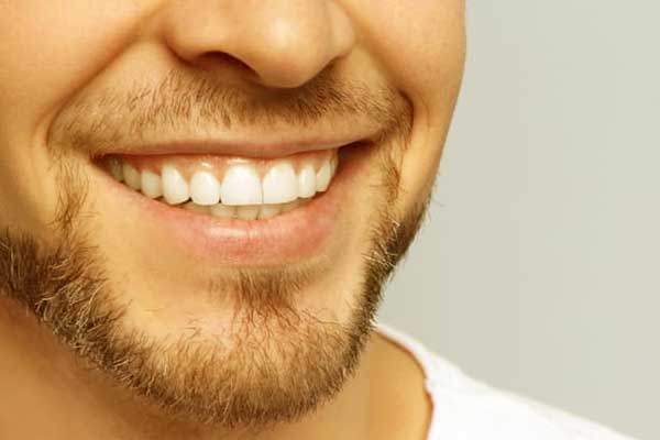 Smile Makeover (Hollywood Smile) in Turkey