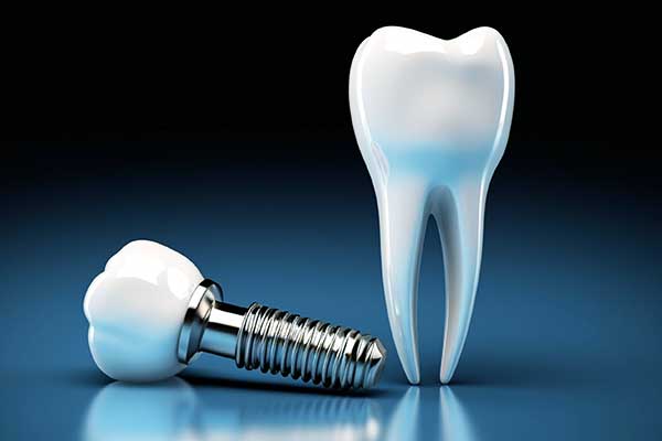 best dental implants in turkey