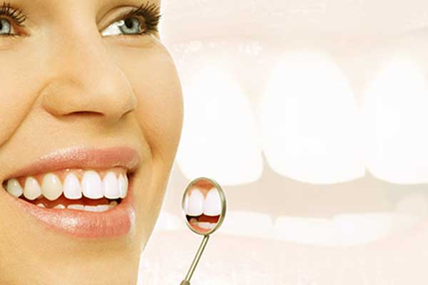 Blanqueamiento Dental