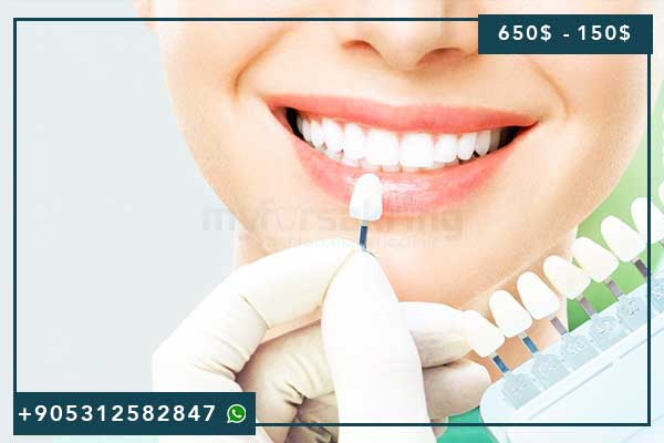 prix des soins dentaires en Turquie, soins dentaires Turquie, implants dentaires Turquie, tourisme dentaire Turquie, coût soins dentaires Turquie, facettes dentaires Turquie, couronnes dentaires Turquie, All-on-4 Turquie, clinique dentaire Istanbul, dentiste Turquie, prix implant dentaire Turquie, soins esthétiques dentaires Turquie