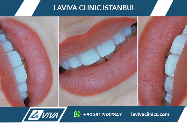 Zahnarzt für Implantate