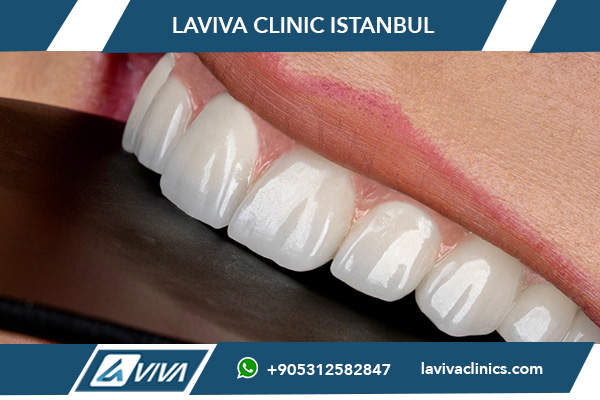 Radiografías Dentales