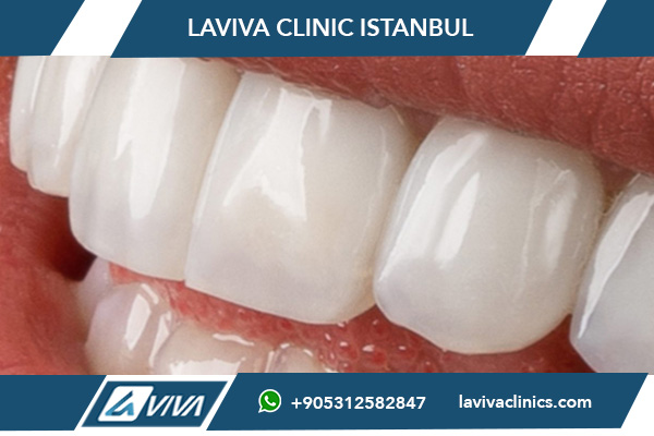 Mejor clínica dental de estética en Estambul