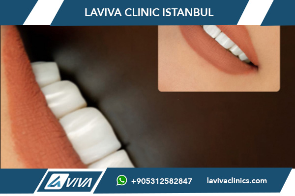 Zahnklinik für ästhetische Zahnmedizin in Istanbul