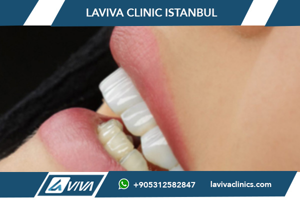 Mejor clínica dental en Turquía