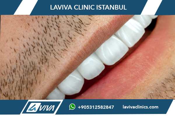 Pflege nach der Zahnimplantation