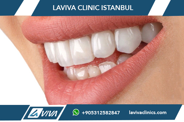 Implantologia Dentale in Turchia