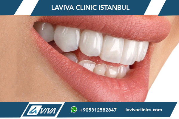 Tipos de implantes dentales