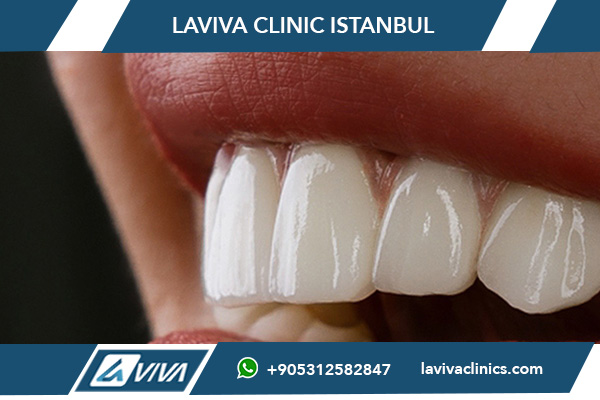 Этапы имплантации зубов