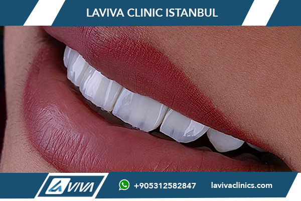 clinica dentale in Turchia