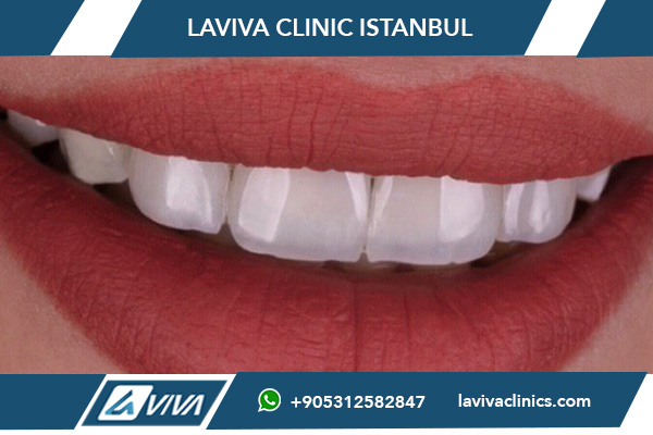 Сложные случаи имплантации зубов