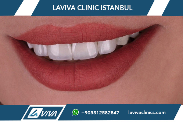 Il miglior dentista implantologo in Turchia