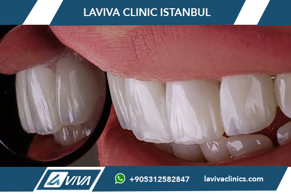 Zahnarzt für ästhetische Zahnmedizin