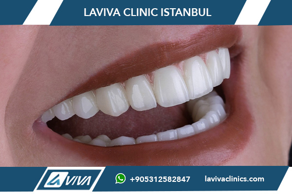 Casi complessi di implantologia dentale