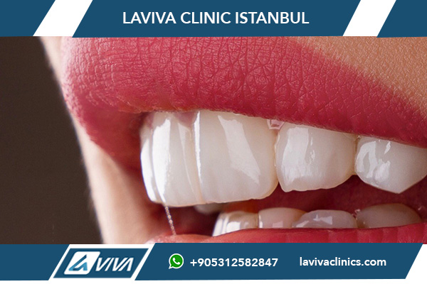 Injerto óseo para implantes dentales