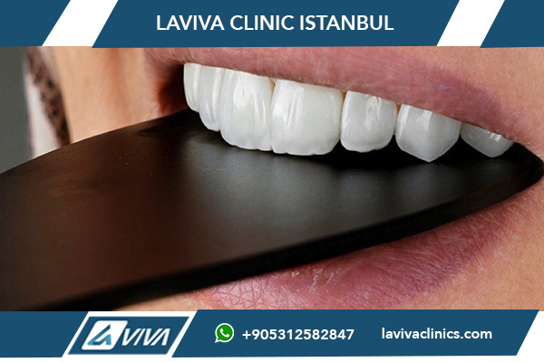 Виды зубных виниров