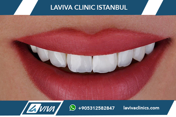 Cura dopo l’impianto dentale