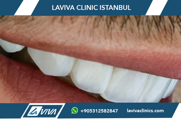 Mejor dentista de estética dental en Turquía