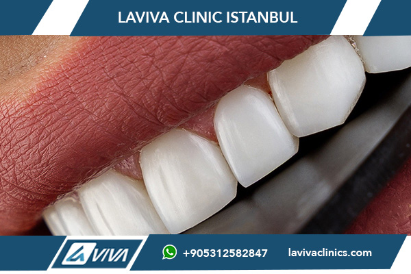 Protesi dentali fisse e mobili