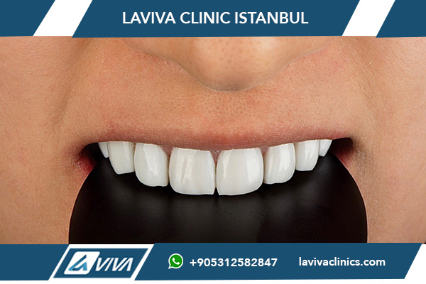 Phasen der Zahnimplantation